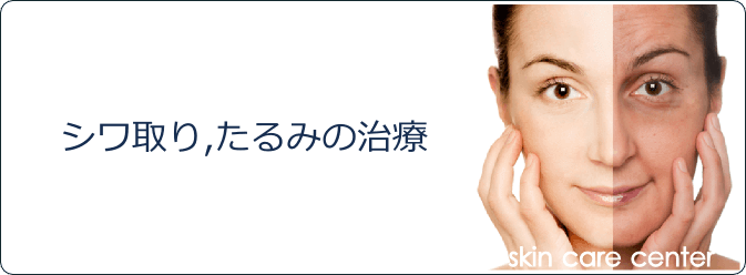 たるみ治療 シワの改善 たるみ治療 シワの改善