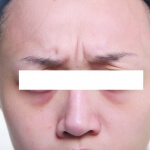before2