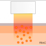 FRAC3-small