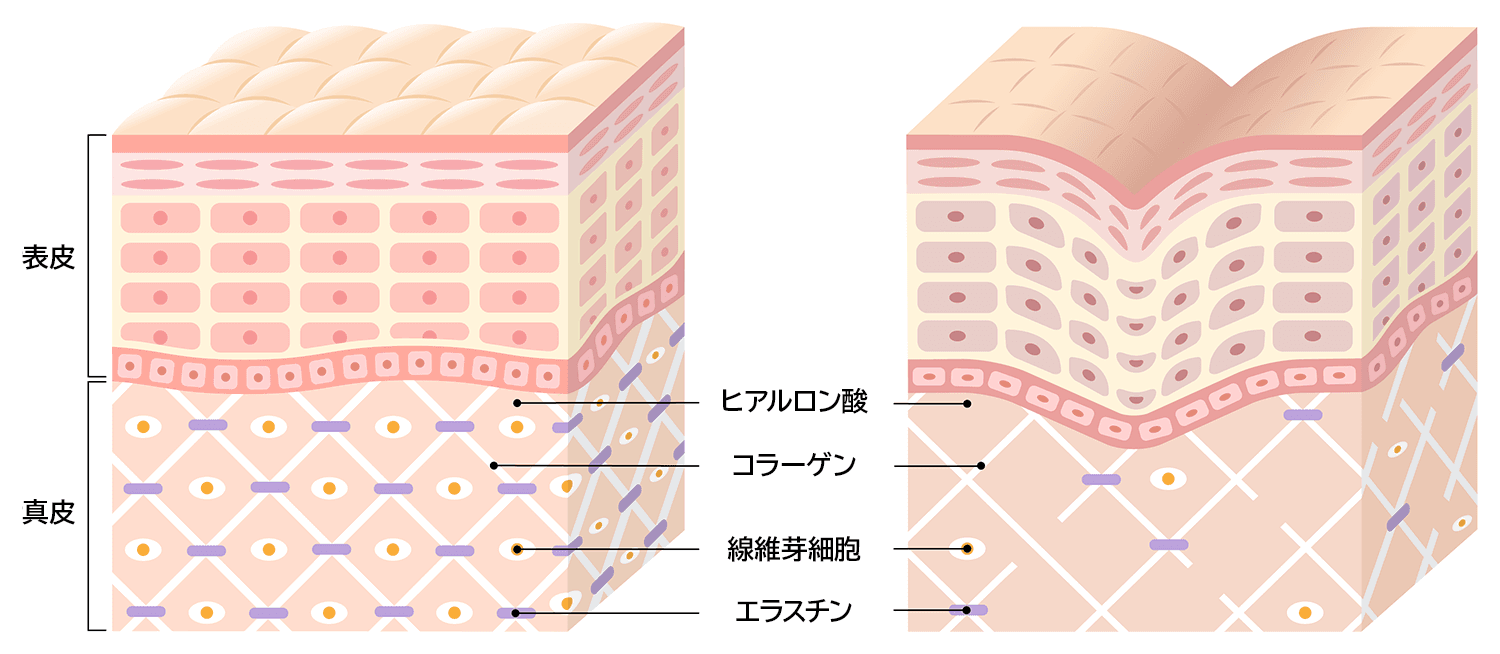 皮膚の断面図