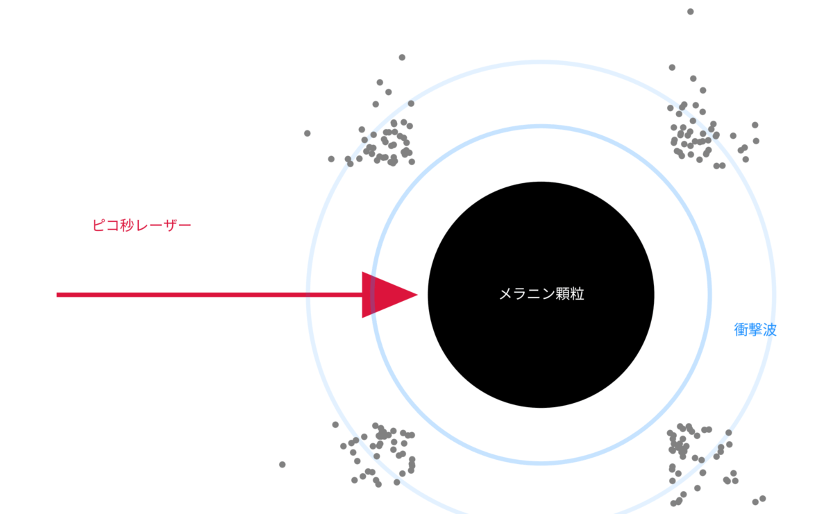 ピコ秒レーザーによるLIOB概念図