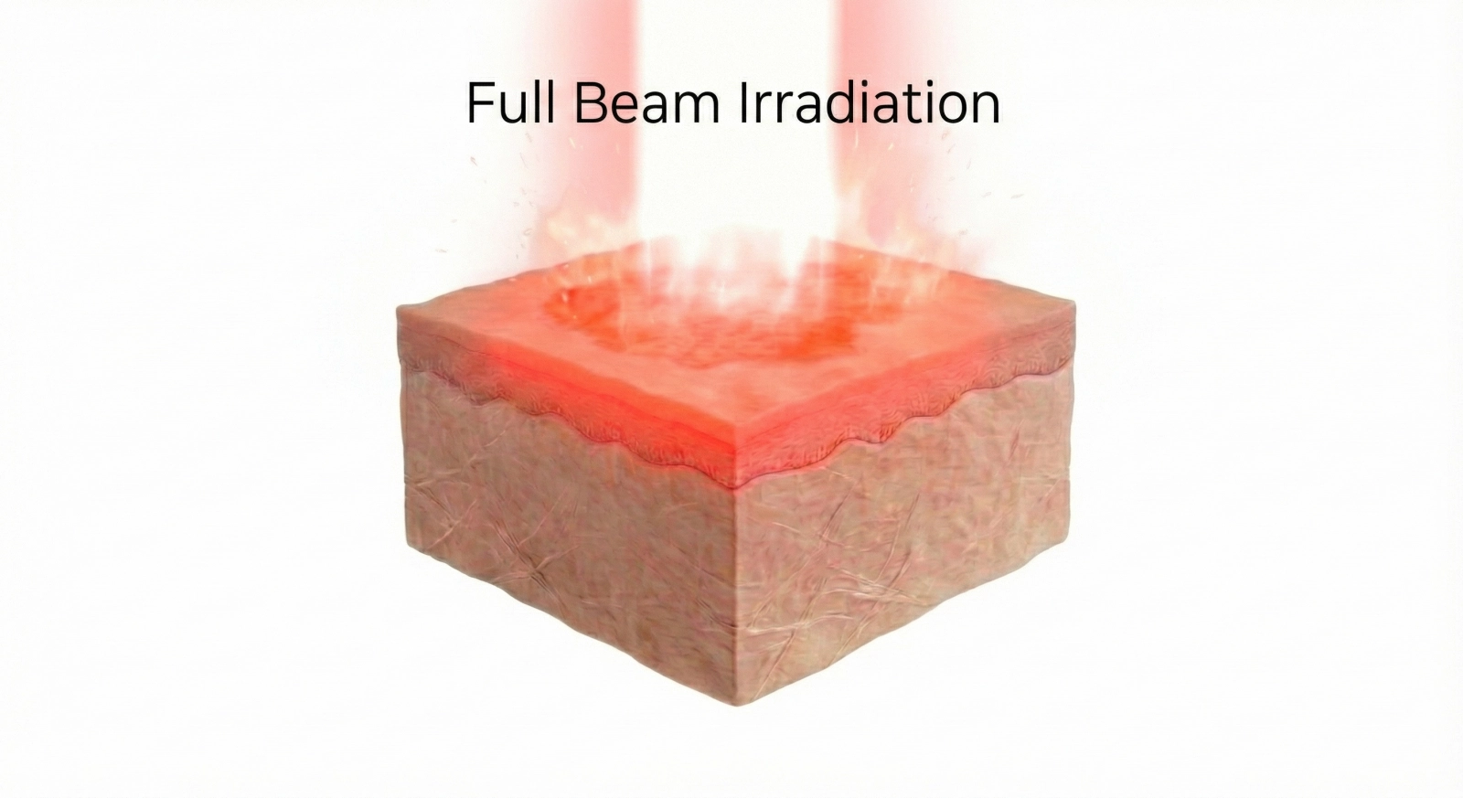 フルビーム照射