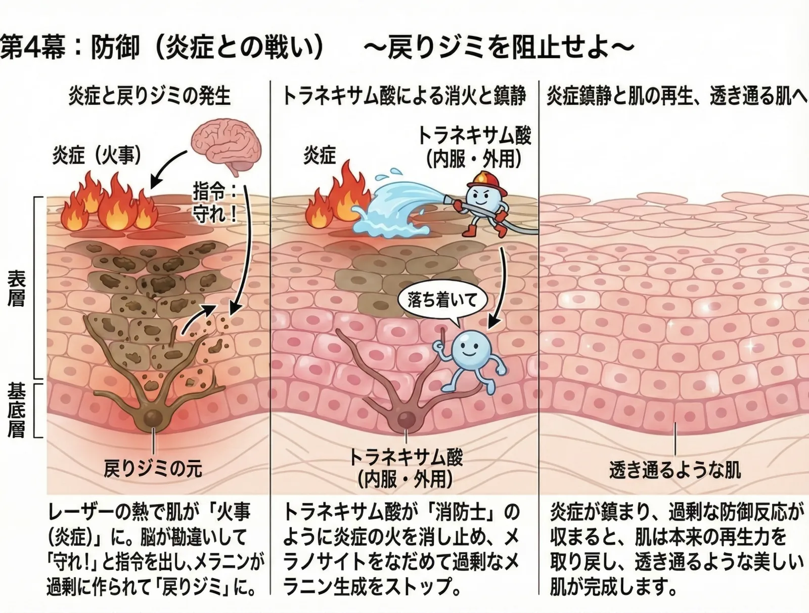第4幕戻りシミを阻止せよ