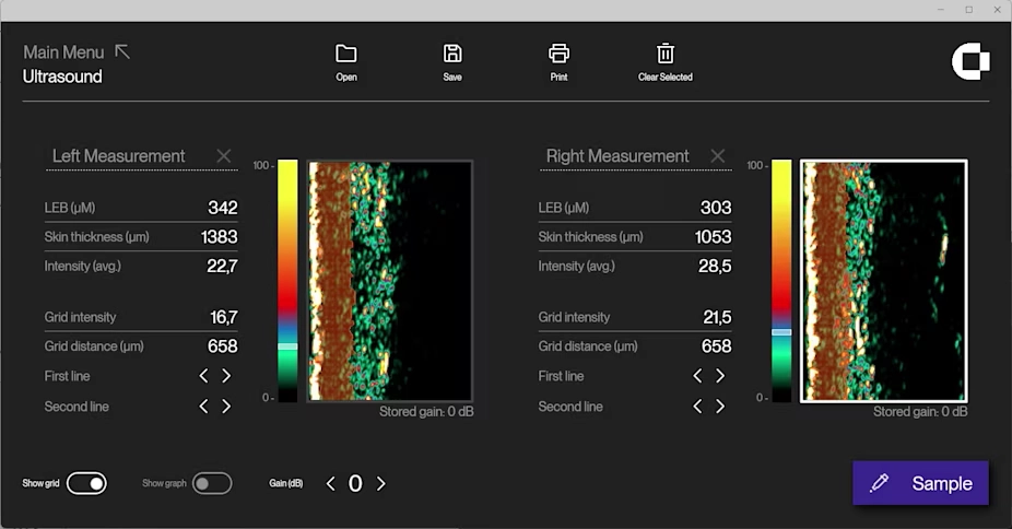 ダーマラボによるSLEB測定画像