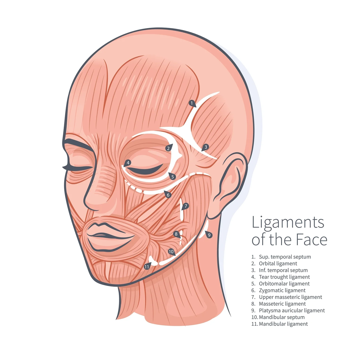 顔の支持靭帯（Ligaments of the Face）：11か所の靭帯位置を示す解剖イラスト