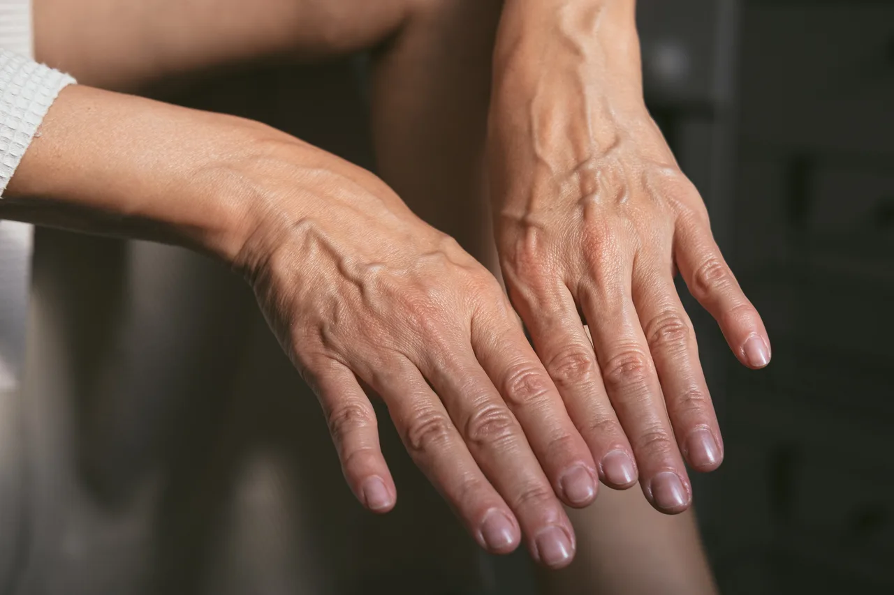手の甲のしわと浮き出た血管(ハンドベイン)が見られる50代女性の手