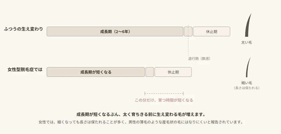 生え変わりの周期を2本の帯で比べた図。女性型脱毛症では成長期が短くなり、太く育ちきる前に生え変わるが、長さは保たれる