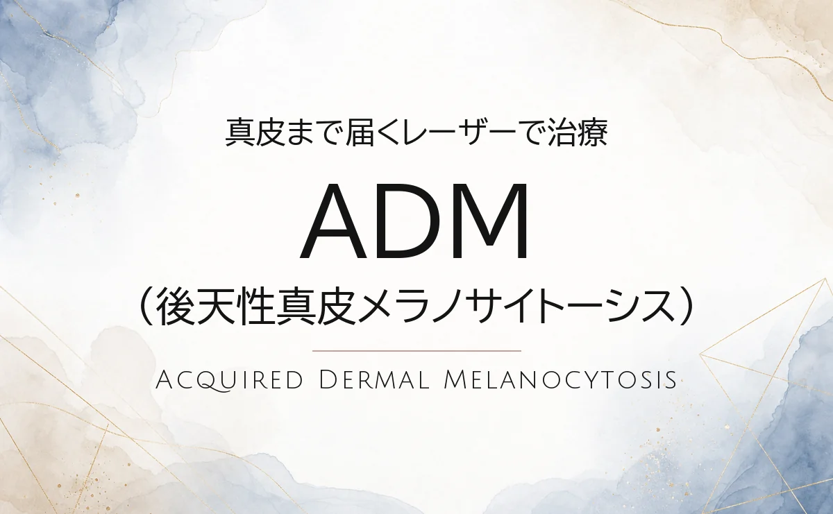 ADM（後天性真皮メラノサイトーシス）の治療｜ソララクリニック（仙台）